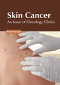 Skin Cancer: An Issue of Oncology Clinics