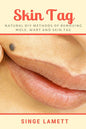Skin Tag: Natural DIY Methods of removing Mole, Wart and Skin Tag