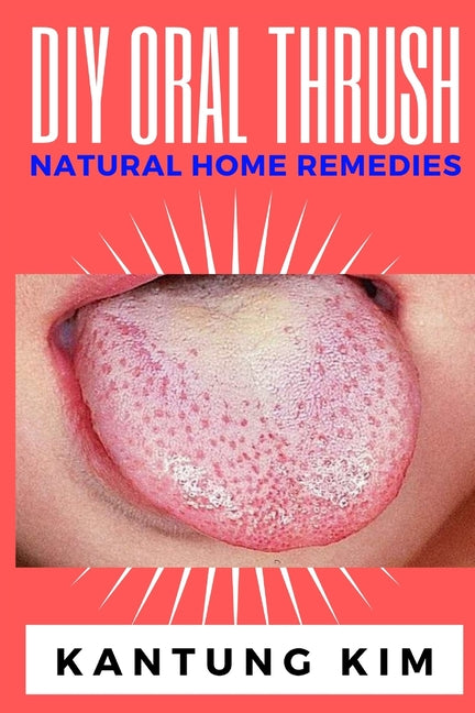 DIY Oral Thrush Natural Home Remedies: The Effective Step By Step Guide To Permanently End Oral Thrush