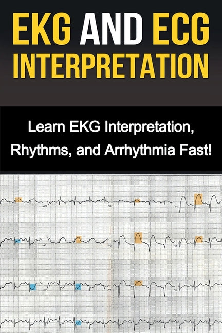 EKG and ECG Interpretation: Learn EKG Interpretation, Rhythms, and Arrhythmia Fast!